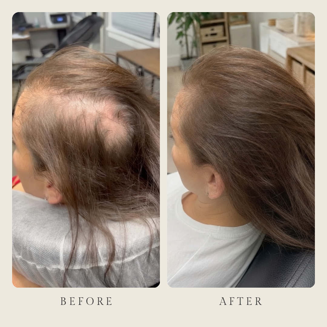healix_before_after.png